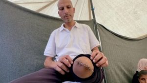 Ισραηλινά νοσοκομεία μετατρέπονται σε κολαστήρια - Αναισθησία με το σταγονόμετρο σε χειρούργηση Παλαιστινίων